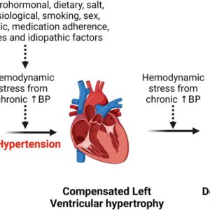 Hypertension → Type 2 Diabetes → Cardiovascular Disease: Mechanisms, Organ Targets, and Reversal Strategies