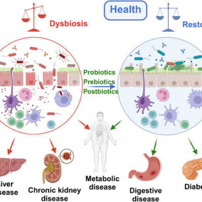 Oxidative stress serves as a unifying driver across metabolic diseases, connecting nutrient overload, mitochondrial dysfunction, inflammation, and gut dysbiosis.