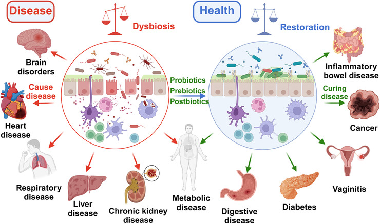 Oxidative stress serves as a unifying driver across metabolic diseases, connecting nutrient overload, mitochondrial dysfunction, inflammation, and gut dysbiosis.
